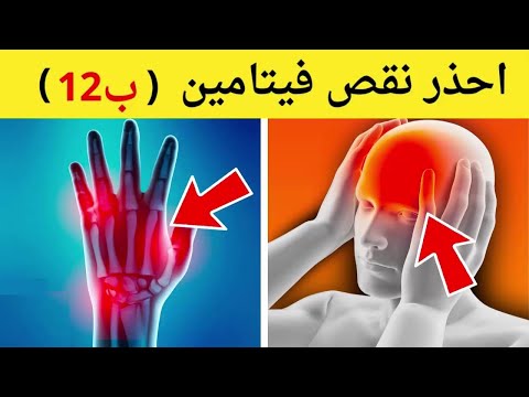 أكثر 10 علامات تحذيرية تأكد أنك تعاني من نقص فيتامين ب 12| تحذير الأطباء من نقص B12 على حياتك!