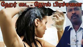 Rs.0 | ஹேர் டை அழற்சி | தோல் அரிப்பு | Hair Dye Inflammation | itching skin