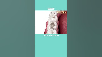 Trám răng Inlay - Nha Khoa Quốc Tế KAIYEN