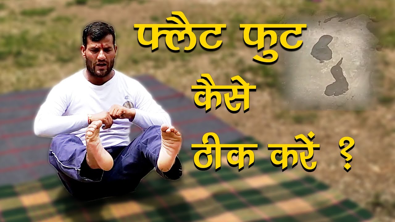 Flat Foot Problem Solution