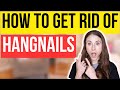 How to get rid of a hangnail fast