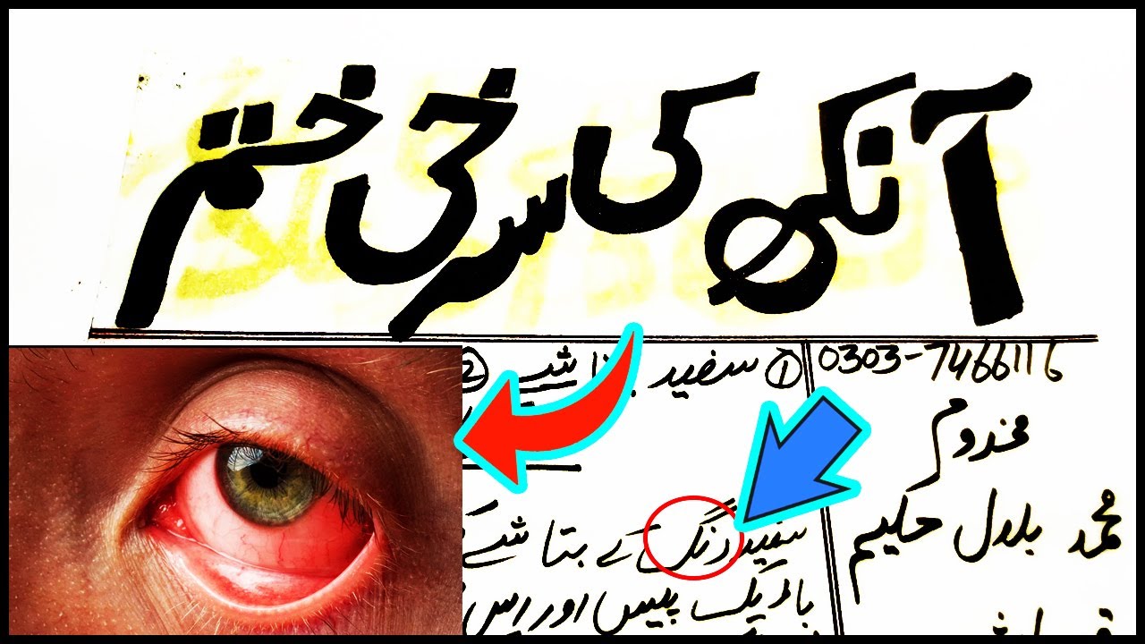 Eye Redness Ka Ilaj Red Eyes Causes Red Eye Infection Treatment Aankhon