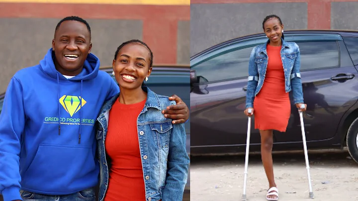 EMOTIONAL  LIVING WITHOUT A LEG - I SURVIVED CANCE...