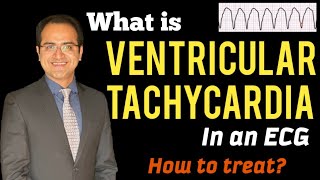 Ventricular Tachycardia (VT) ECG Interpretation, Treatment (ACLS Management), Lectures, USMLE, NCLEX