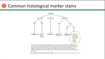 Tumor diagnosis recharacterization enabled by comprehensive genomic profiling powered by PGDx