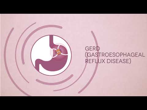 Gastrointestinal Problems & Symptoms | Digestive System Diseases | Fortis Bangalore