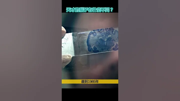 愛因斯坦的大腦，究竟與常人有何不同？ - 天天要聞
