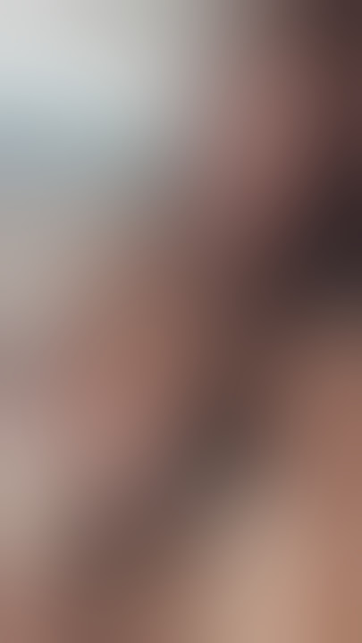 Boobs as Big as Melons?! You Won't Believe Your Eyes! 🍈🔥 #Shorts