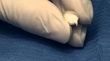 Provitemp -Temporary cement