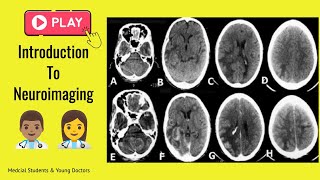 👉🏻 Brain Imaging, Crash Course ☑️
