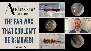 THE EAR WAX THAT COULDN'T BE REMOVED - EP617