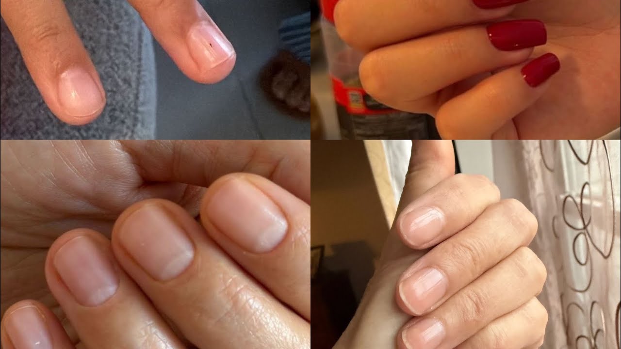 Прямой эфир 22 Февраля» Здоровые ногти: уход, ошибки и восстановление» 