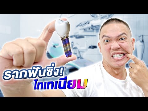 รีวิวทำรากฟันเทียมไทเทเนียม!!! จะดีกว่าฟันเดิมไหม???