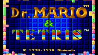 SNES Video Split Screen Comparison - Composite VS S-Video (SNS 101)