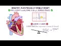 Ventricular tachycardia