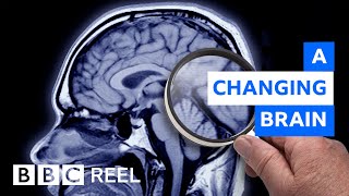 How pregnancy dramatically resculpts the brain  BBC REEL