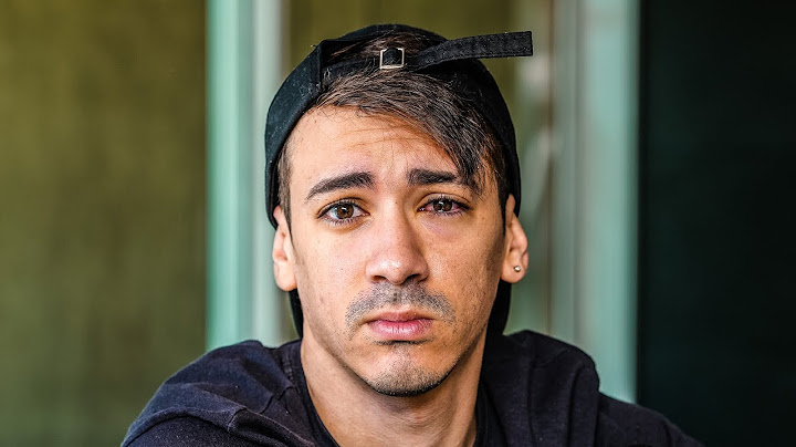 mano oque aconteceu com olho dele?  ‹ EduKof ›