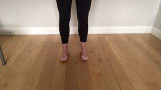 medial/lateral hindfoot dissociation