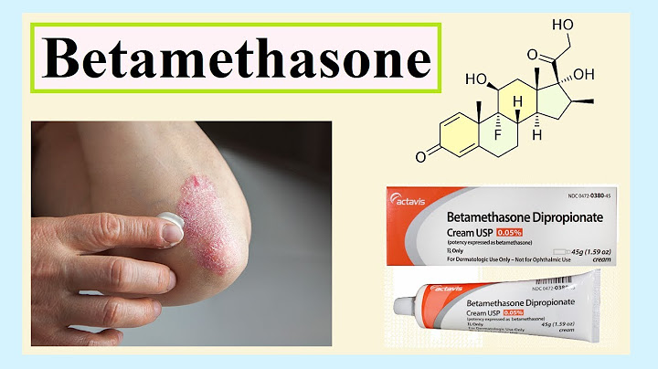 Augmented betamethasone dipropionate ointment over the counter