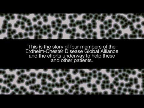 Uncovering Rare Disease: Erdheim-Chester Disease (ECD) Video (20 minutes)