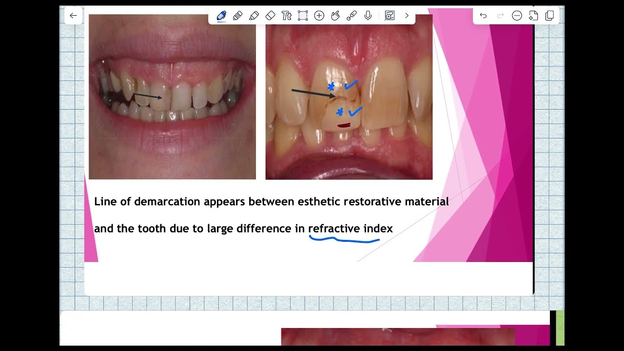 في السريع منه ||  optical properties|| Material 