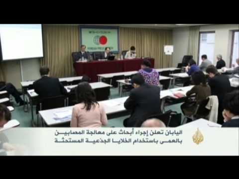 تجارب استخدام خلايا جذعية لعلاج العمى باليابان