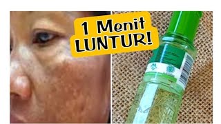 CARA MUDAH MENGHILANGKAN FLEK &KULIT KUSAM DG CEPAT 