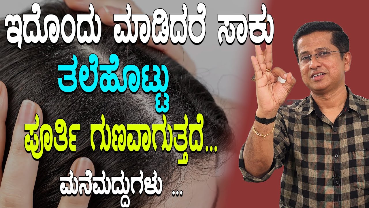 ಇದೊಂದು ಮಾಡಿದರೆ ಸಾಕು  ತಲೆಹೊಟ್ಟು  ಪೂರ್ತಿಯಾಗಿ  ಗುಣವಾಗುತ್ತದೆ ..  | natural remedy for dandruff
