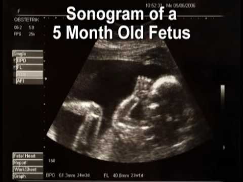 Pregnancy: Weeks 17-20 (Month #5)