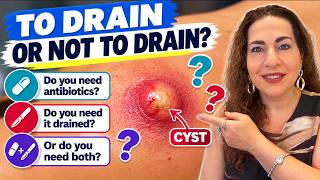Infected Cyst or Abscess? Drainage, Antibiotics & More