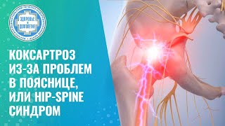 картинка: 👨‍⚕️ Коксо-вертебральный синдром, или как при лечении спины не потерять сустав!?