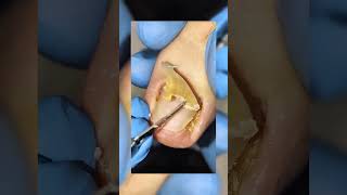 beautiful nails. #dirtynailss #dirty #nails #viral