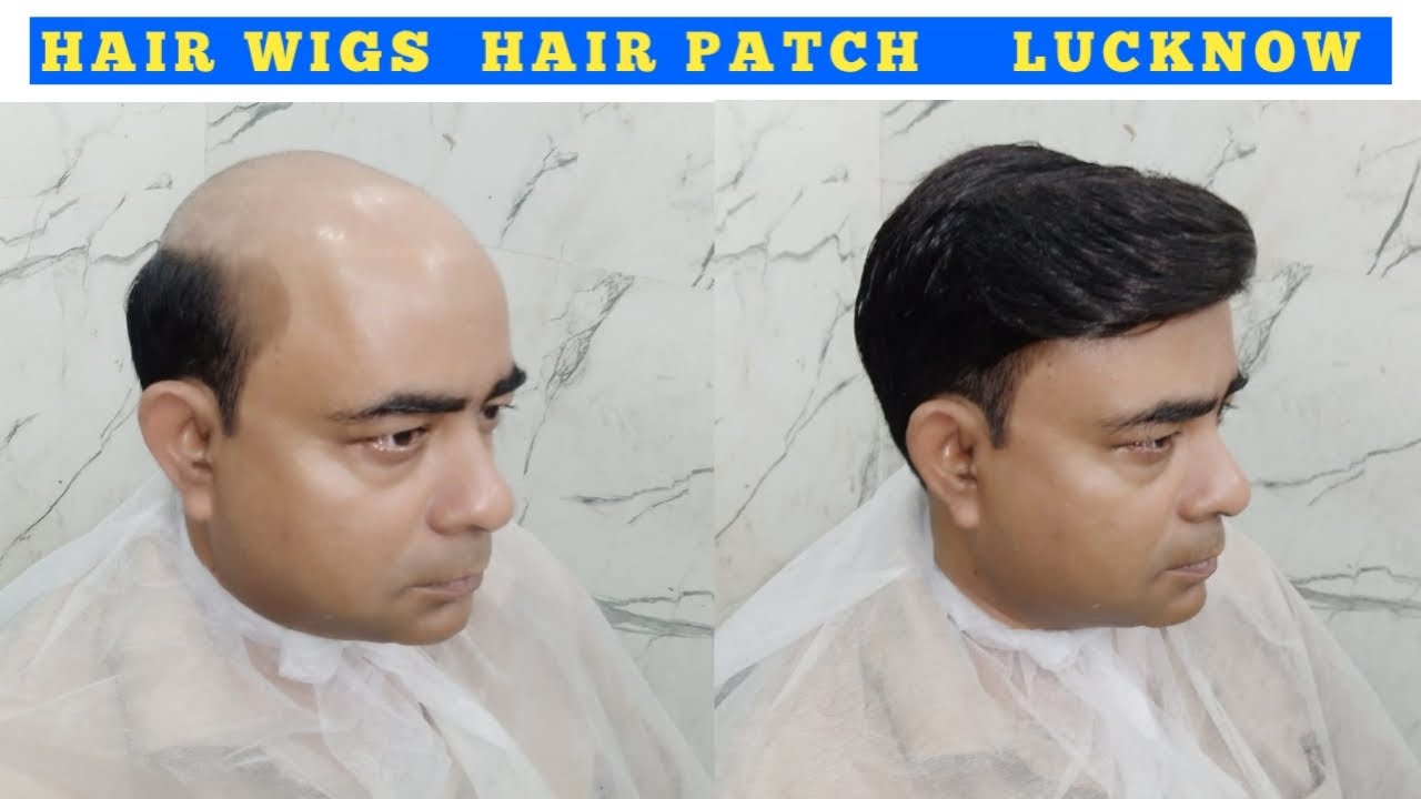 Hair Wig Hair Patch Hair Fixing Lucknow Wig Shop In Lucknow