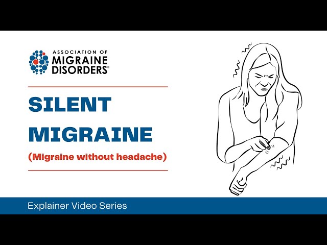 What is Silent Migraine (without headache)? - Chapter 1: Migraine Types -  Explainer Video Series class=