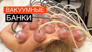 Какая польза от вакуумных банок? Почему расслабляются мышцы после вакуумного массажа ?