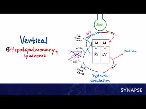 USMLE Step 1 - Ортопноэ vs Платипноэ