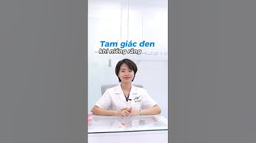 Tam giác đen khi niềng răng