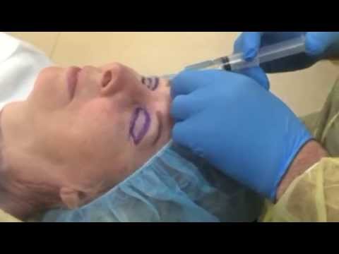 Live Eyelid Surgery At The Arizona Eye Institute & Cosmetic Laser Center