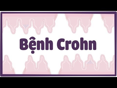 Bệnh Crohn (viêm đường tiêu hóa)