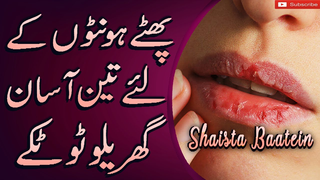 Phaty Hont Ka Ilaj/Gharelu Totke Khushk Hont Life Hacks For Dry Lips