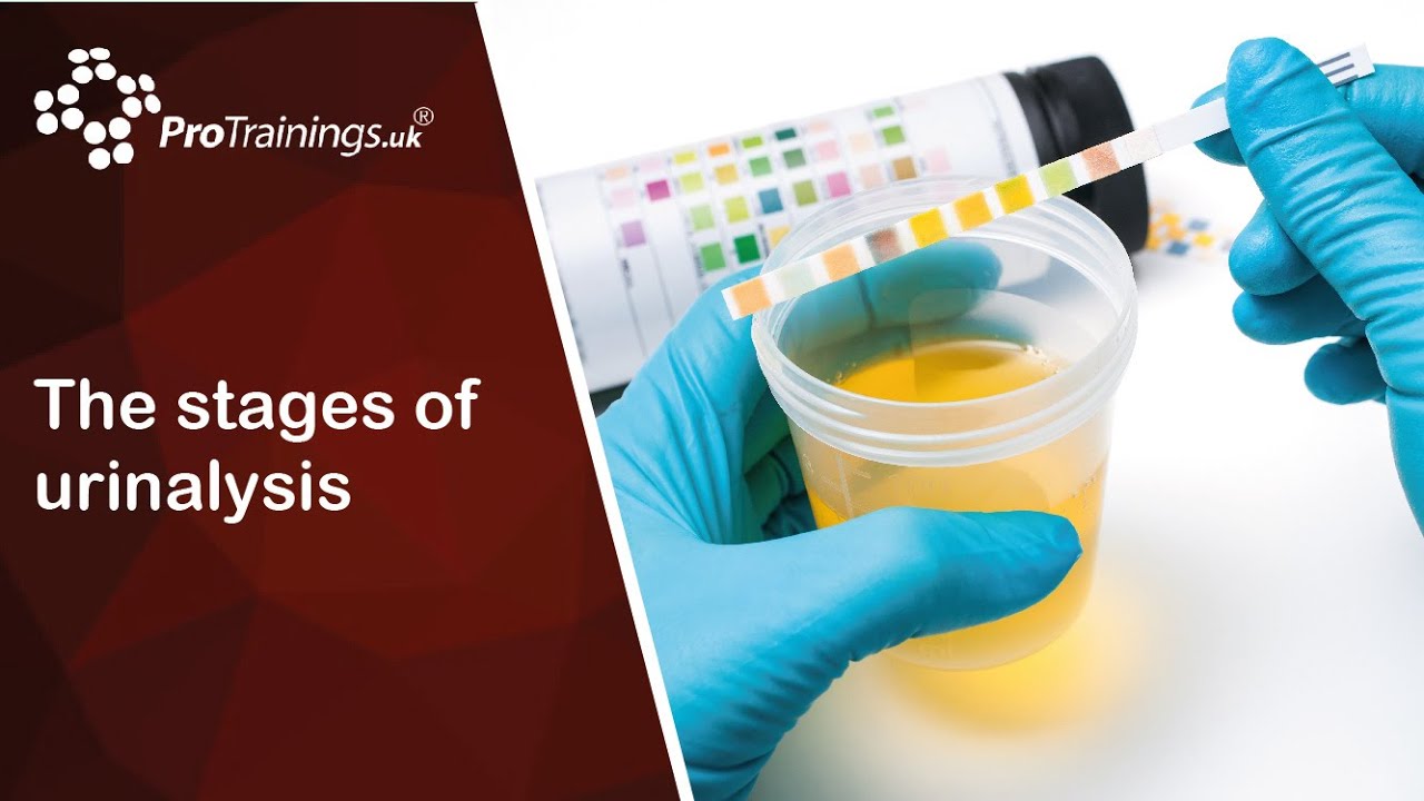 The stages of urinalysis YouTube