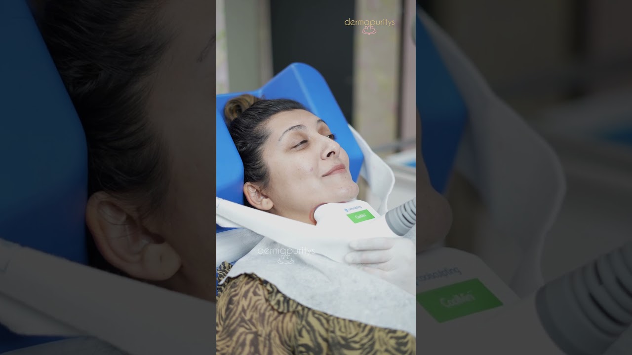 Derma Puritys | CoolSculpting For Double Chin