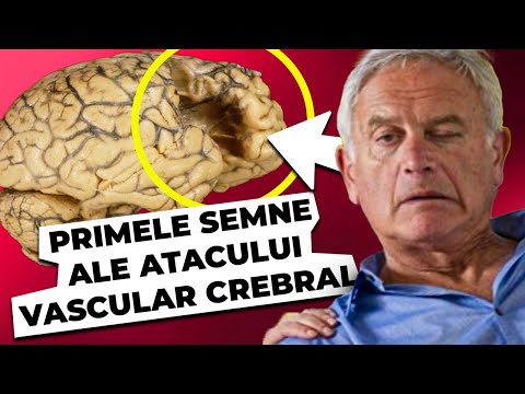 Video: Cum să știți dacă o pisică a avut un accident vascular cerebral (cu imagini)