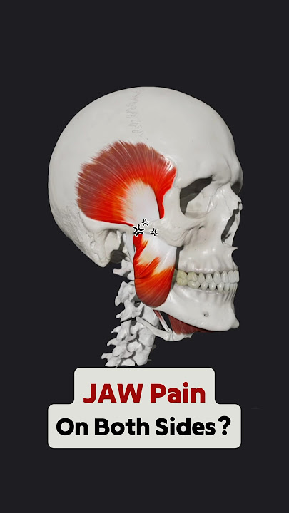 This could be why your Jaw Pain is on BOTH sides! #jawpain #jaw #jawpainrelief #tmj #tmjdisorder