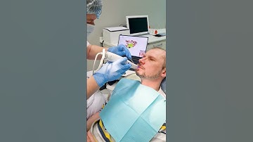 Слепки - это прошлое, 3D сканер - это будущее. Casts are the past, 3D scanner is the future.