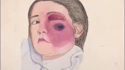 Lit Sci Med Film Competition: 