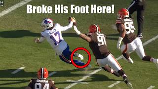 Josh Allen Fractured His Foot And Kept Playing - Doctor Explains Surgery Update