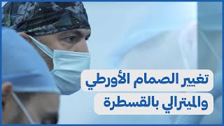 TAVI | تغيير الصمام الأورطي والميترالي بالقسطرة