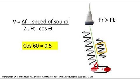 Ultrasound Doppler angle simplified