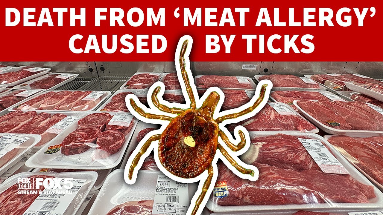 1st death linked to 'meat allergy' known as alpha-gal syndrome